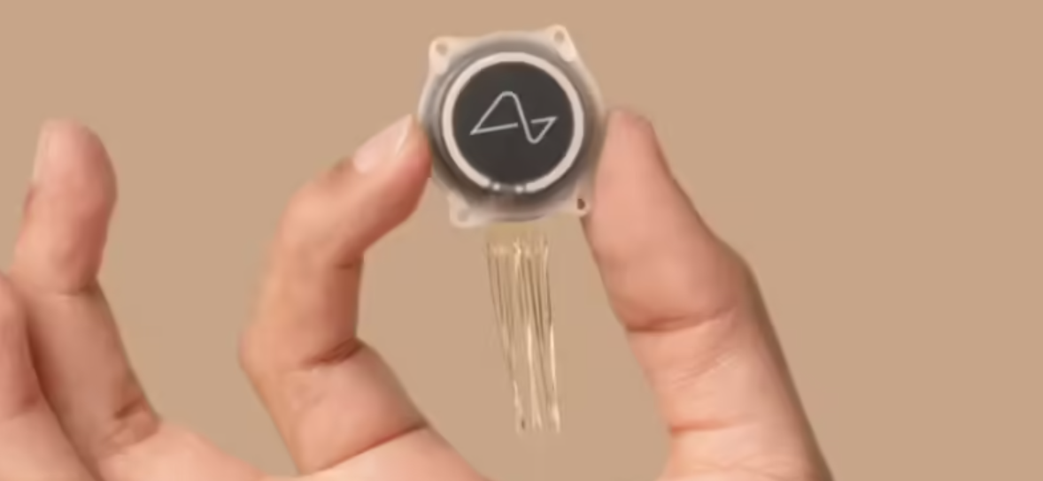 Neuralink：有 1 万人等着在颅骨里植入我们的 N1 脑机接口芯片插图